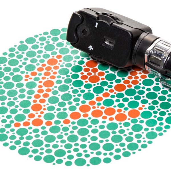 Equipo de diagnóstico visual